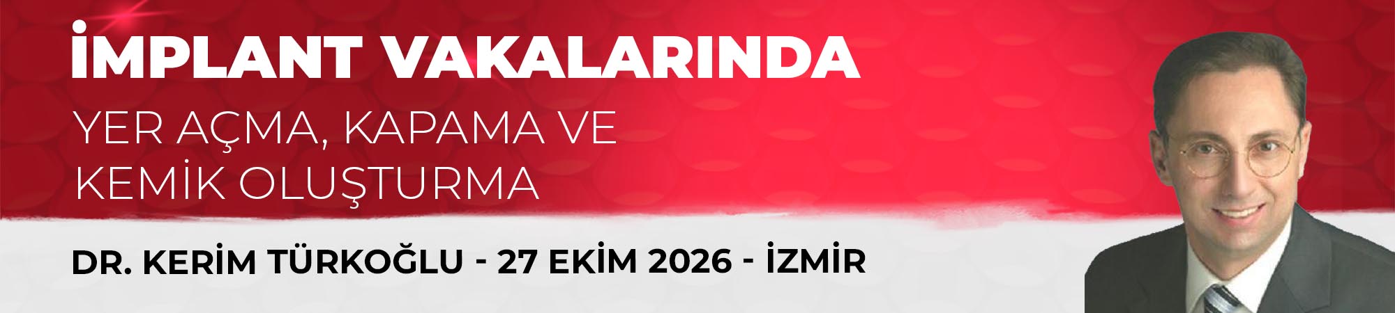 İmplant Vakalarında Yer A&ccedil;ma, Kapama ve Kemik Oluşturma